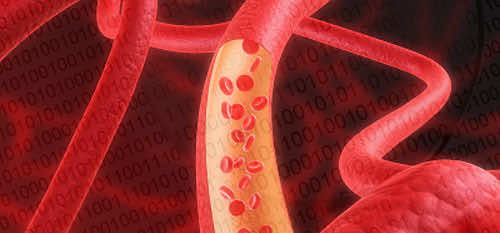 流体-構造相互作用を利用した柔軟な動脈内の血流の数値シミュレーション
